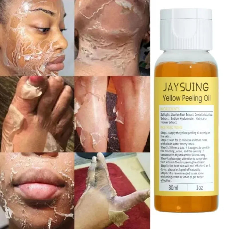 Yellow Peeling Body Oil Dead Skin Remover Cleansing Exfoliation For Tender Glowing Skin Moisturizing Care Beauty Products
